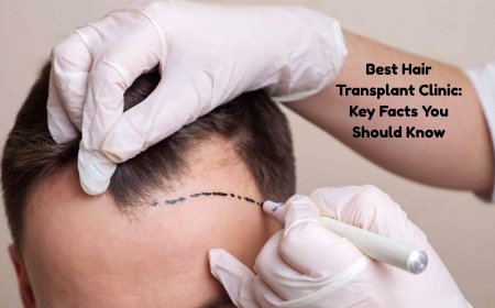 Best Hair Transplant Clinic: Key Facts You Should Know