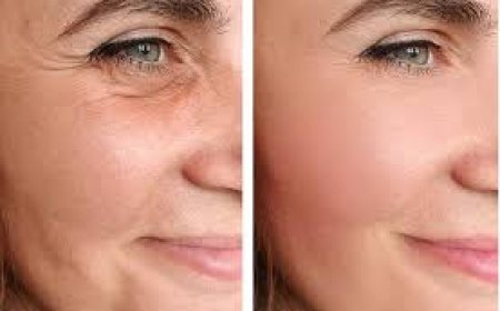 Comparing Facelift and Breast Lift Costs: Which is Worth It?