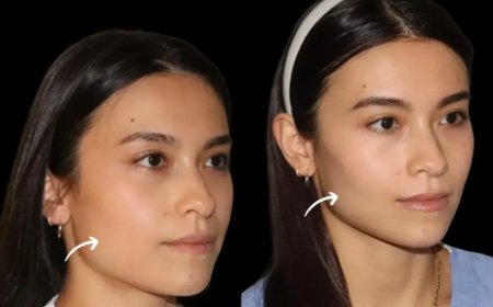 Concierge Aesthetic Services: Best Plastic Surgeons in Dubai Offering Home-Based Sculptra Fillers Sessions