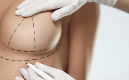 Breast Reduction in Riyadh: Sculpting Comfort and Grace