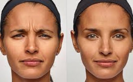 Dysport Near Me | GaliDerm Aesthetics – West Palm Beach FL