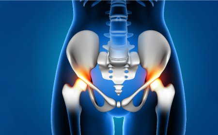 Best Hip Replacement Surgeon in Jaipur: Reviews, Cost & Experience