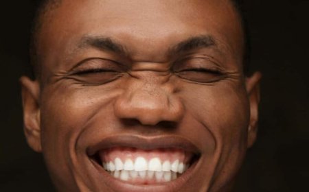 How Can You Brighten Your Smile with Teeth Whitening Waxhaw?