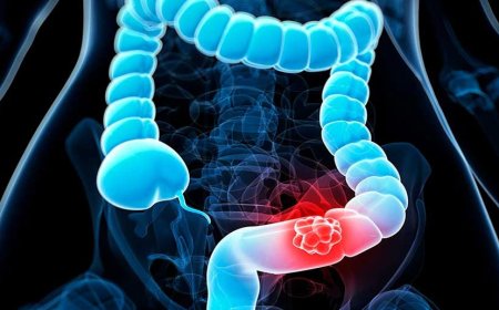 Colorectal Cancer Therapeutics Market Size, Growth, and Strategic Outlook