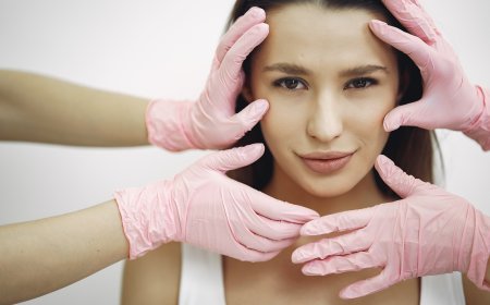 SMAS Facelift Before and After Real Results, Real Rejuvenation