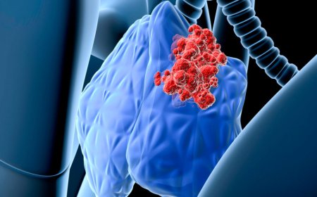 Thymic Carcinoma Drugs Market Size, Trends, and Strategic Outlook 2025-2032