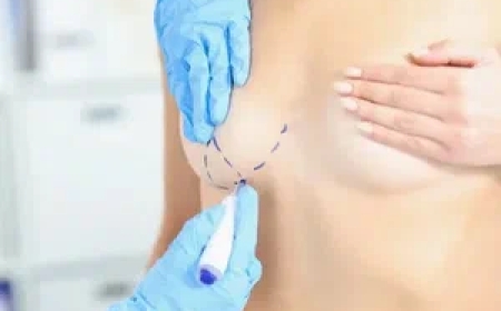 تصغير الصدر في الرياض: استشارات مجانية وخدمات مميزة