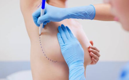 كيف تختار أفضل دكتور تثدي بالرياض؟