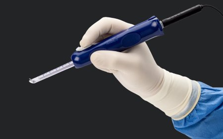 Advancements and Growth in Carpal Tunnel Release System Market