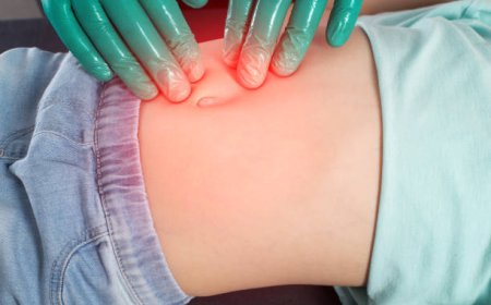 جراحة الفتق في الرياض: تكلفة العملية وأفضل العروض