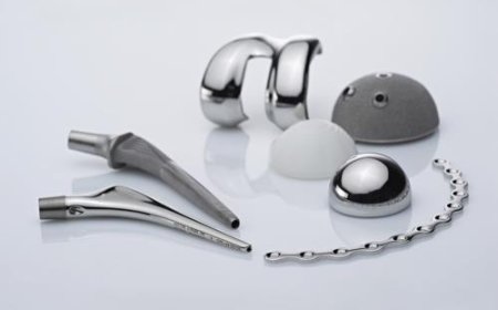 Evolution and Strategic Outlook of the Medical Implants Market