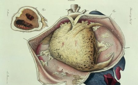 Recurrent Pericarditis Market Size, Trends, and Growth Strategies Analysis