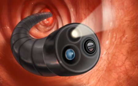 Technological Advances Driving Growth in the Colonoscopy Devices Market